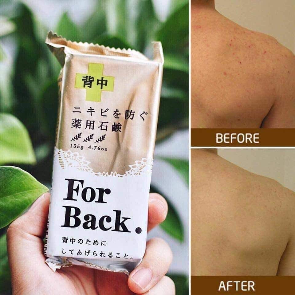 Xà phòng trị mụn lưng For Back Medicated Soap - Nhật Bản - 美好 MeiHao